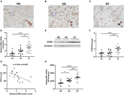 Cigarette Smoke Promotes Interleukin-8 Production in Alveolar Macrophages Through the Reactive Oxygen Species/Stromal Interaction Molecule 1/Ca2+ Axis